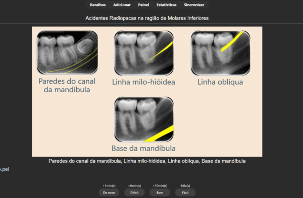 348 FLASHCARDS de RADIOLOGIA Odontológica: Teoria e Pratica - Imagem 4