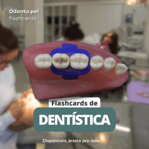 70 Flashcards de dentistica: Nomenclatura, Lesões, Isolamento e Ajuste oclusal
